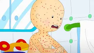 Chicken Pox | Caillou Cartoon