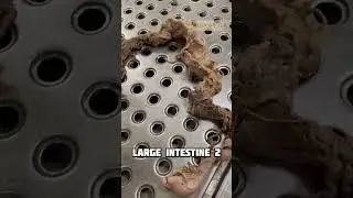 Large Intestine 2 #15 | Anatomy Abdomen and Pelvis | #mbbs #neet #viral #shorts #shortfeed