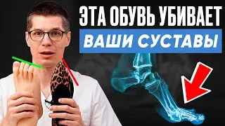 Никогда не носите ЭТУ ОБУВЬ! 3 самые ВРЕДНЫЕ ПАРЫ обуви для стоп!