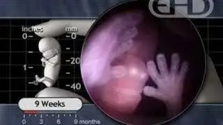 Fetal Development -- The Eyelids Close