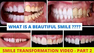 💫💫creative beautiful smile | smile transformation before and after Time-lapse | smile correction