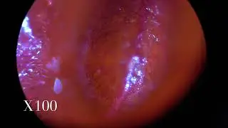 딸기 확대 사진 X40~X1000 , Strawberry, Microscrope Microworlds JMTV