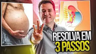 The 3 Steps to Managing Patients with Ascites