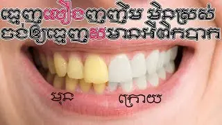 #3 Remove Yellow Teeth,ធ្មេញលឿង ទៅជាស ស្រស់ស្អាត តែមួយម៉ាត់