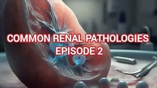 Kidney diseases episode 2