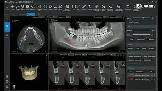 Powerful simulation planting function