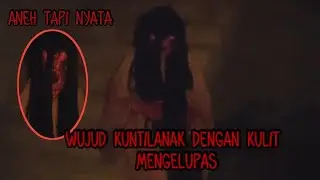 WUJUD KUNTILANAK DENGAN KULIT MENGELUPAS KAYA BEKAS LUKA BAKAR