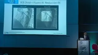 Dr. Arellano video: IA en Intervenciones Coronarias