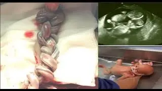 The Doctor Asked A Woman To Keep Her Pregnancy A Secret And What Happens