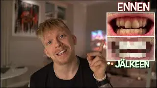 Mun elämänI suurin muutos...
