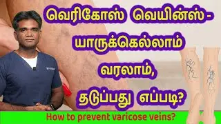 What are Varicose Veins, Who Are At Risk Of Developing This, How To Prevent? Dr.P.Sivakumar-In Tamil