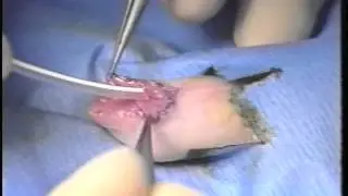 Creation of a Hypospadias Animal Model and Microsurgical Hypospadias Reconstruction