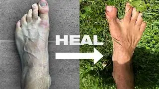 How Barefoot Training Heals the Body