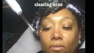 Dftv High Frequency Treatment
