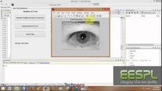 Matlab Iris Recognition | Iris feature extraction (latest Project 2020)