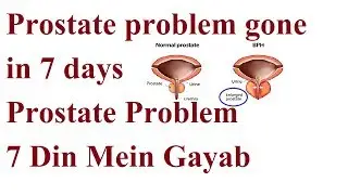 Prostate problem gone in 7 days | Prostate Problem 7 Din Mein Gayab