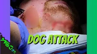 I was attacked by a dog (NOT CLICKBAIT)