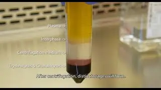 Isolate PBMCs with Lymphopure™