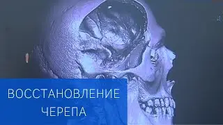 Операция по восстановлению черепа