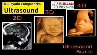 Nuucyada computerka uur ku jirta      ULTRASOUND LESSON 3 MODES
