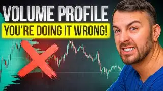 ❌ The Worst 3 Mistakes in Volume Profile Trading