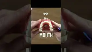 How to do turns on your expander - Braces 101 w/ TheBracesDoc