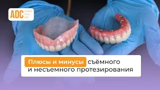 ПЛЮСЫ И МИНУСЫ СЪЕМНОГО И НЕСЪЕМНОГО ПРОТЕЗИРОВАНИЯ