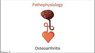 Osteoarthritis