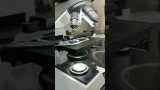 Seminal fluid examination🤔 ✔️Semen Analysis Test😱#trending#viral#medical#lab #shorts#youtubeshorts