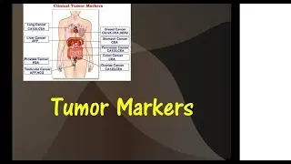 Tumor Markers in Cancer diagnosis and Monitoring