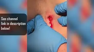 Best the Emergency Room