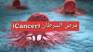 ماهو السرطان (Cancer)؟ وماأسبابه والاعراض التى تظهر على المريض ؟ وطرق علاجه ؟