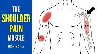 The Shoulder Pain Muscle (How to Release It for INSTANT RELIEF)