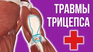 TRICEPS INJURY - Rupture, Strain, Surgery, Treatment | BENCH PRESS