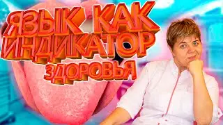 👅Язык как зеркало здоровья: Откройте глаза на болезни