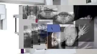 Myray X9 la CBCT di ultima generazione