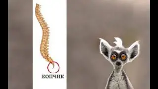Нестабильность, подвывих/вывих копчика