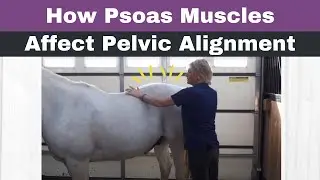 Psoas muscles affecting pelvis alignment