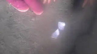 ТБИ 1 серия
