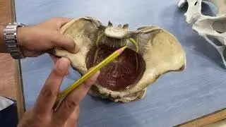 pelvis model | muscle of pelvis | palvic floor | lumbar pluxes | @jjmedicose7601