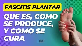 FASCITIS PLANTAR: QUE ES, COMO SE PRODUCE Y COMO SE CURA 👣