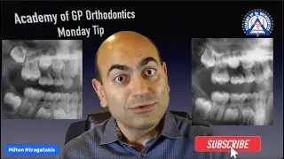Monday Tip: Ectopic Eruption of Molars