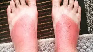 I Cant Walk