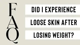 My loose skin after my 55 pound weight loss was so minor! I was shocked.