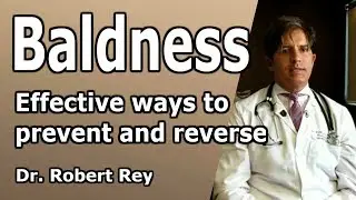 Dr. Rey – Baldness – find out the only effective ways to prevent and reverse it!