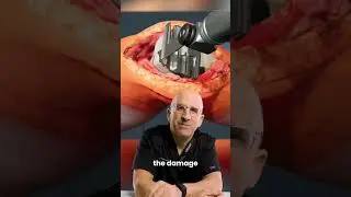 Only CURE for Knee Arthritis 