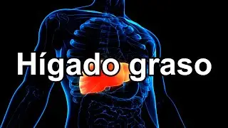 El hígado graso