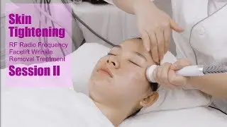 MYCHWAY RF Radio Frequency Facial EMS Electroporation Facelift Wrinkle Removal Machine Session II