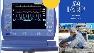 ICU RNs: Principles of Counterpulsation of IABP
