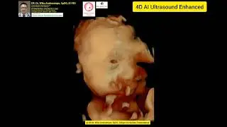 4D Artificial Intelligence Ultrasound